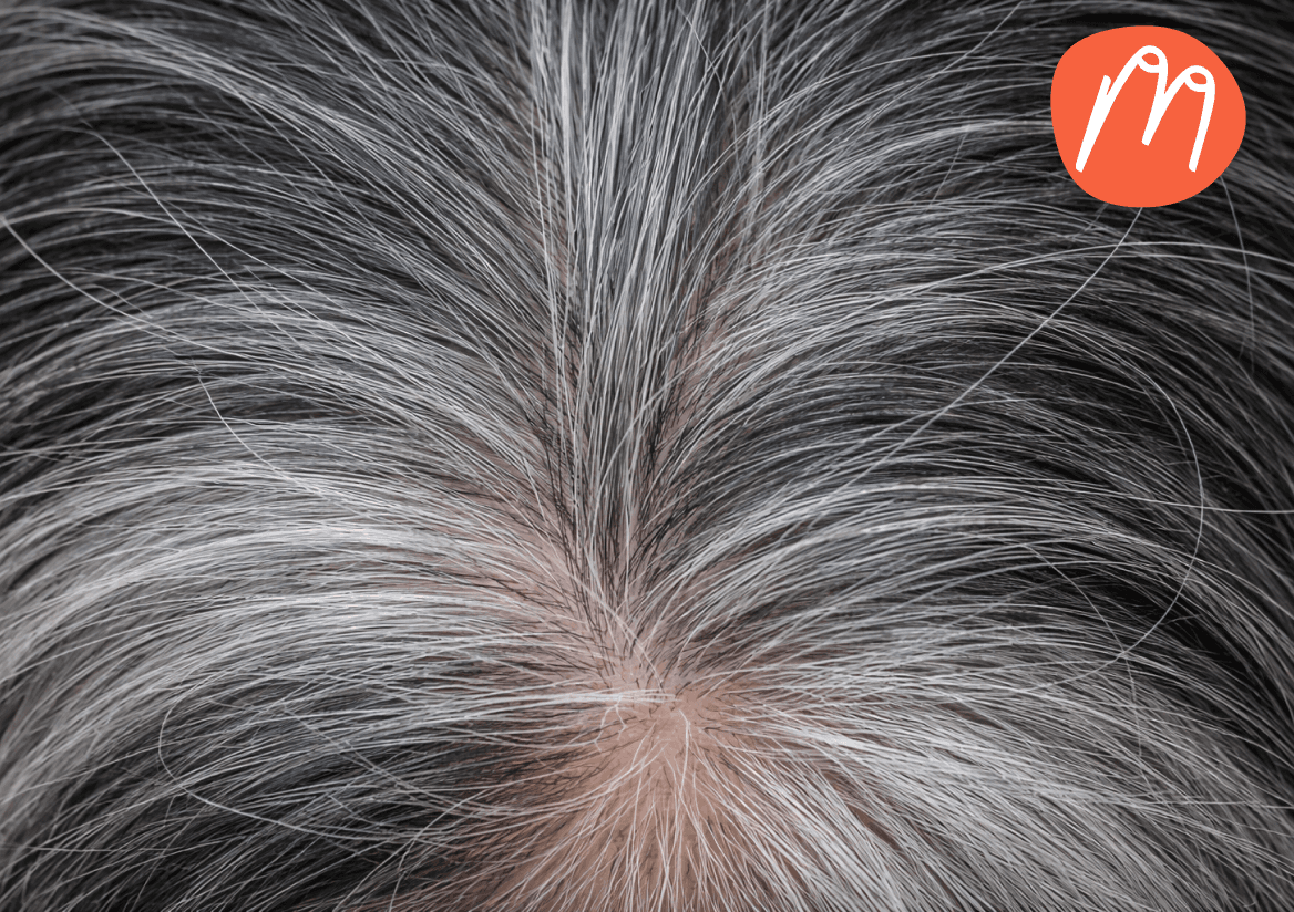 Warum Haare grau werden – und warum das mehr mit deinem Leben zu tun hat, als du denkst